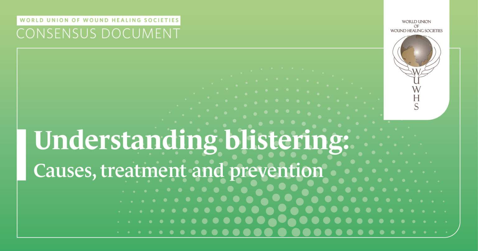 Understanding blistering: Causes, treatment and prevention – Wounds ...