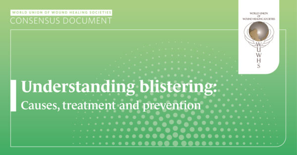 Understanding blistering: Causes, treatment and prevention – Wounds ...